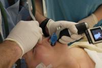 Trachėjos intubacija Tipai, technika, komplikacijos