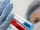 Diagnoza HIV: kdaj in katere teste je treba opraviti